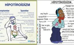 Hipotiroidizm nedir?