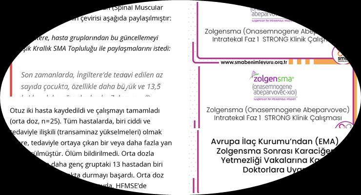 Zolgensma ilacının yararı bilinmiyor