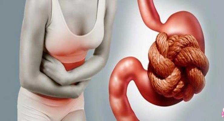 Şiddetli karın ağrısı, ateş, titreme, karında şişlik gibi belirtiler birçok